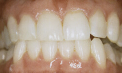 Cosmetic Dentist in Maspeth