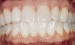 Periodontist in Maspeth