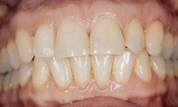 Family Dentist in Maspeth