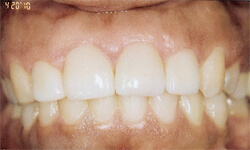 Family Dentist in Maspeth