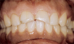 Cosmetic Dentist in Maspeth