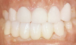 Cosmetic Dentist in Maspeth