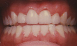 Family Dentist in Maspeth