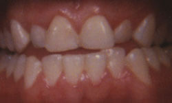 Cosmetic Dentist in Maspeth