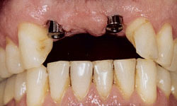 Cosmetic Dentist in Maspeth