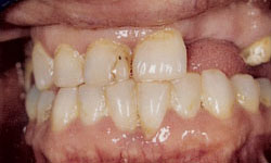 Family Dentist in Maspeth