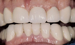 Cosmetic Dentist in Maspeth