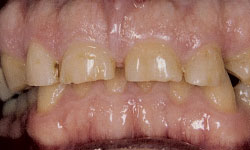 Cosmetic Dentist in Maspeth