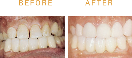 Family Dentist in Maspeth